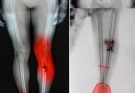 COVID-19 vaccinated individuals may be ill…See more